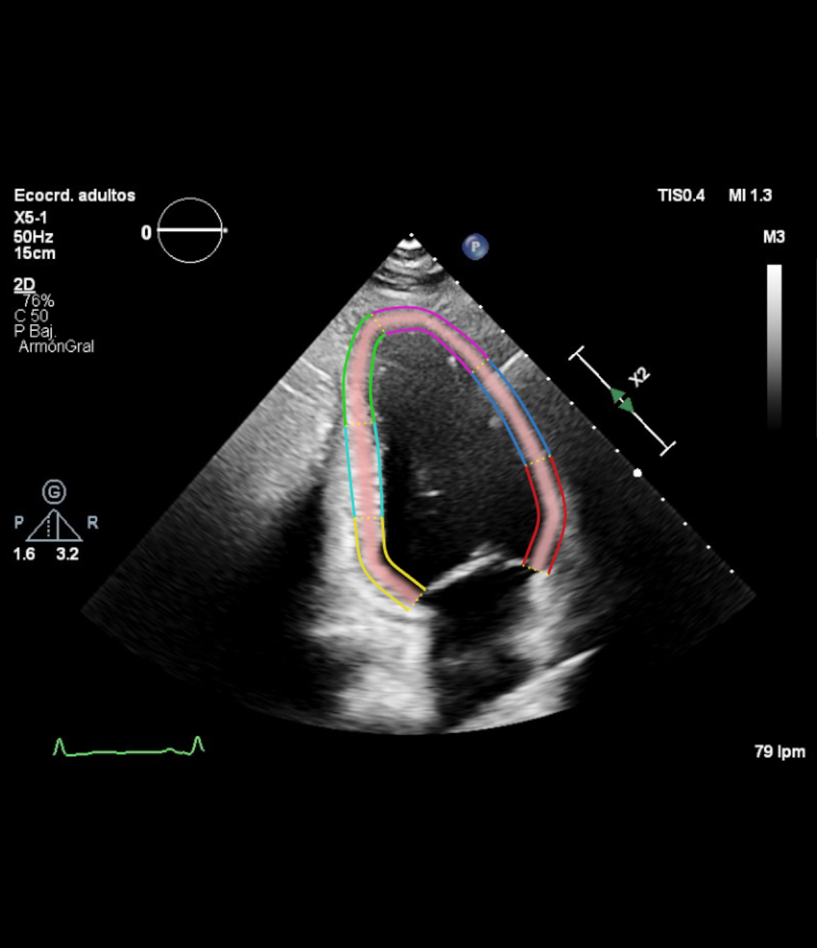 A2C · Curva de strain